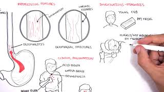 Physiology of Vomiting  Vomiting reflex NEW [upl. by Ahseenyt]