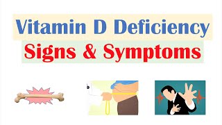 Vitamin D Deficiency Signs amp Symptoms ex Fatigue Diagnosis Treatment [upl. by Nanyt]