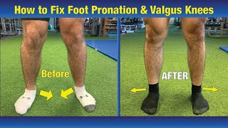 VERY EFFECTIVE Way to FIX Pronated feet amp Knees Caving In Valgus Knees [upl. by Filmer]