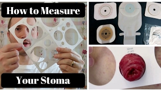 Managing THICK Ostomy Output Stoma Care Tips [upl. by Kath]