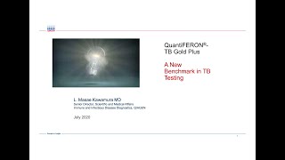 3QuantiFERONTB Gold Plus A New Benchmark in TB TestingDr Masae Kawamura [upl. by Heron]