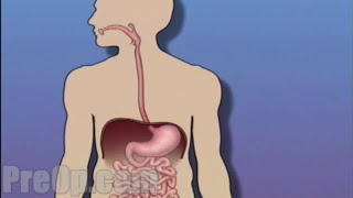 Esophagogastroduodenoscopy [upl. by Aekal]