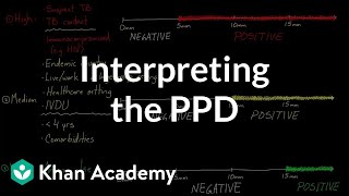 Interpreting the PPD  Infectious diseases  NCLEXRN  Khan Academy [upl. by Mela]