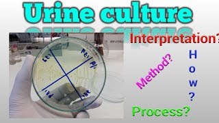 Urine culture test procedure Microbiology [upl. by Safoelc]