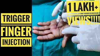 Trigger Finger Injection Technique [upl. by Ahsinej]