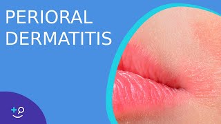 Perioral Dermatitis  Daily Dos of Dermatology [upl. by Ennovyhs961]