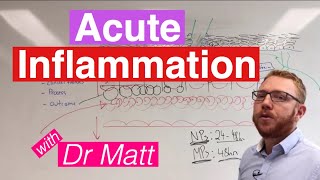 Acute Inflammation  Immunology [upl. by Sulrac950]