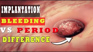 Implantation Bleeding Vs Period – How to Know the Difference 🩸🩸 [upl. by Adnovay462]