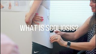 Scoliosis Exercises  Exercises to Improve Scoliosis [upl. by Drawe]