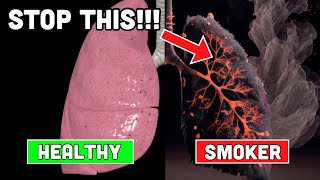 Doctor Explains How to PURIFY Smokers Lungs [upl. by Olly557]