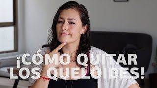 Quitar un queloide paso a paso  Piercings [upl. by Rosemonde]