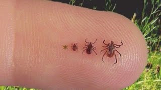 Doctor explains what you should know about ticks [upl. by Chane]