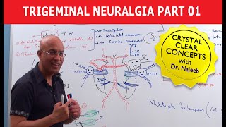 Trigeminal Neuralgia  Causes and Treatment  Part 1 [upl. by Ahseyi]