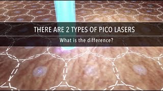 Why Are There Different Types of Pico Laser  Dr Kenneth Thean [upl. by Riva]