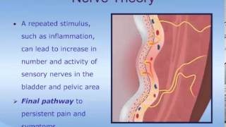 Understanding Interstitial Cystitis ICPainful Bladder Syndrome PBS [upl. by Osner]