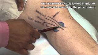 Pes Anserine Bursitis Injection [upl. by Moriah]