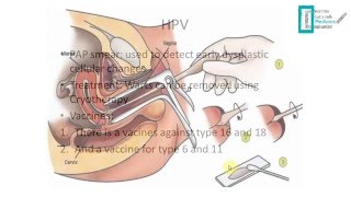 STDs Overview [upl. by Maze]