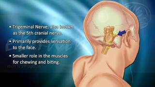 Understanding Trigeminal Neuralgia  eBrainMDcom [upl. by Olegna]