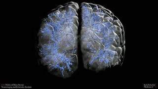 Perivascular spaces [upl. by Schafer]