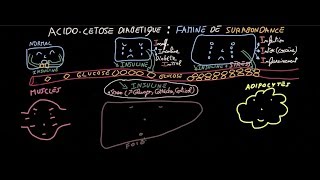 Acidocétose diabétique  Famine de Surabondance  Partie 1  Docteur Synapse [upl. by Nerrual]