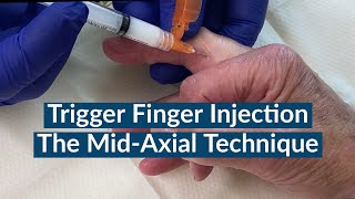 Trigger Finger Injection  The MidAxial Approach [upl. by Derna]