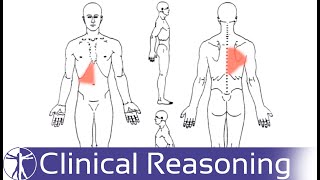 Screening for Visceral Referred Pain in the Thoracic Spine [upl. by Anyal]