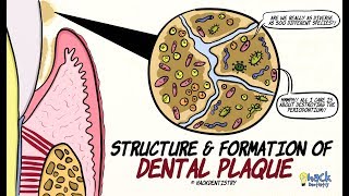 Dental Plaque Structure and Formation [upl. by Naillij]