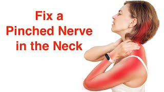 Fix a Pinched Nerve in the Neck With FREE Exercise Sheet [upl. by Derfiniw]